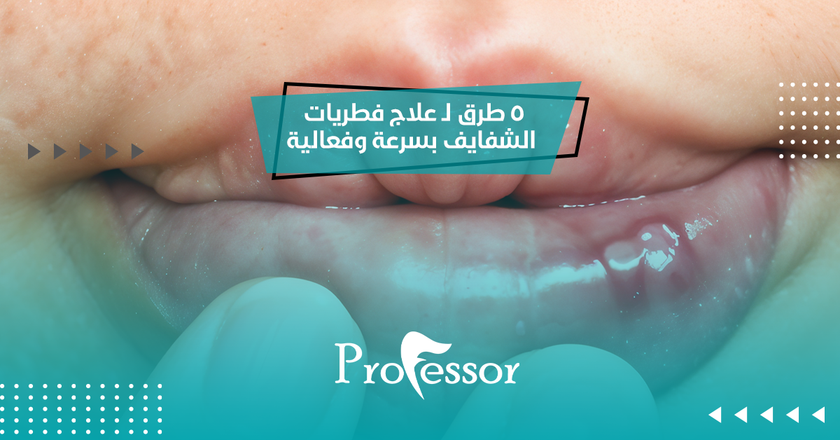 5 طرق لـ علاج فطريات الشفايف بسرعة وفعالية