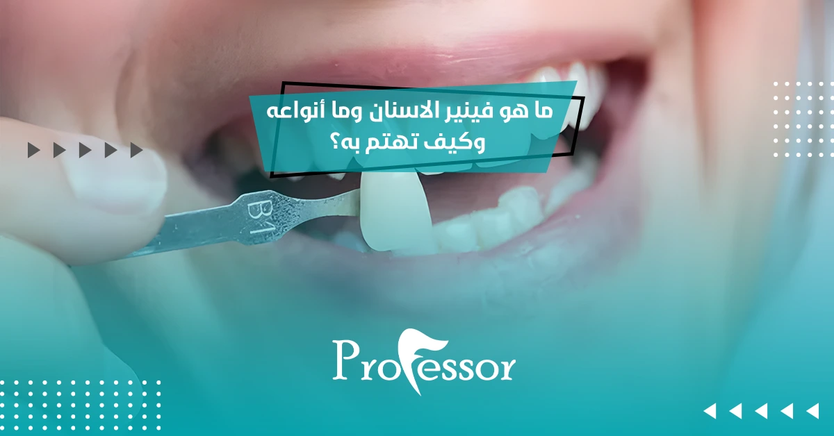 ما هو فينير الاسنان وما أنواعه وكيف تهتم به؟