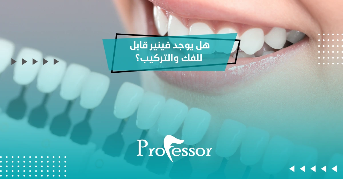 هل يوجد فينير قابل للفك والتركيب؟