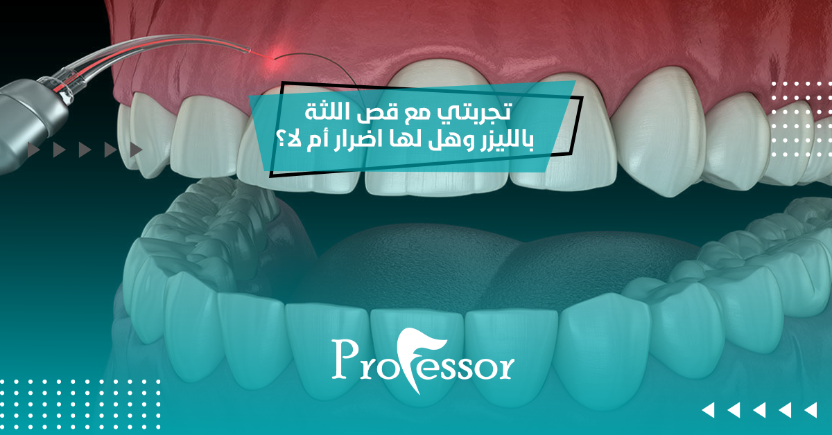 تجربتي مع قص اللثة بالليزر وهل لها اضرار أم لا؟