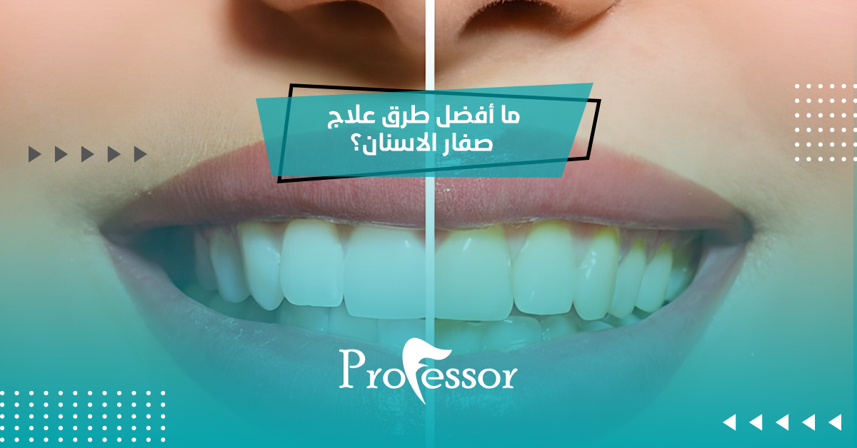علاج صفار الاسنان