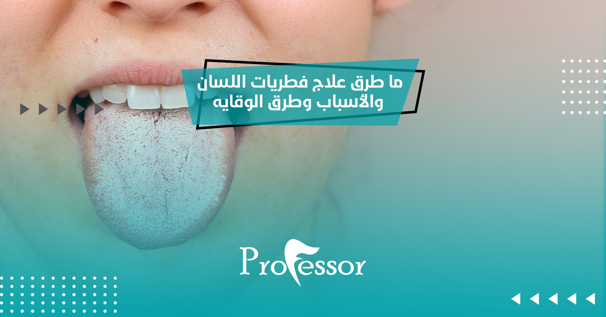 ما طرق علاج فطريات اللسان والأسباب وطرق الوقايه