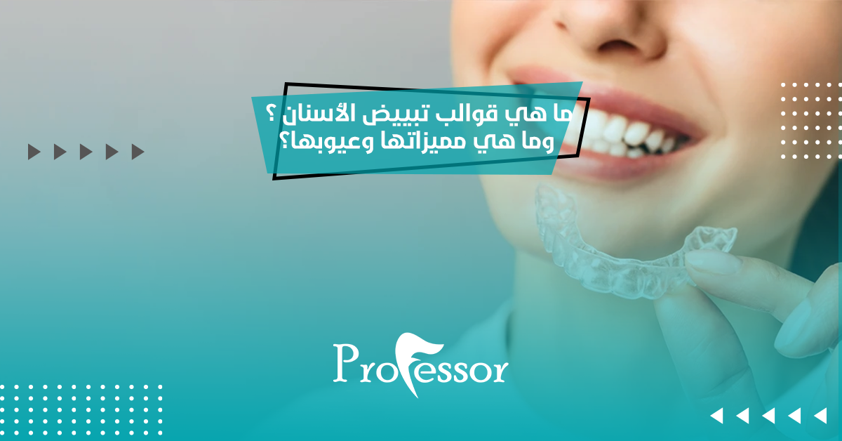 قوالب تبييض الأسنان