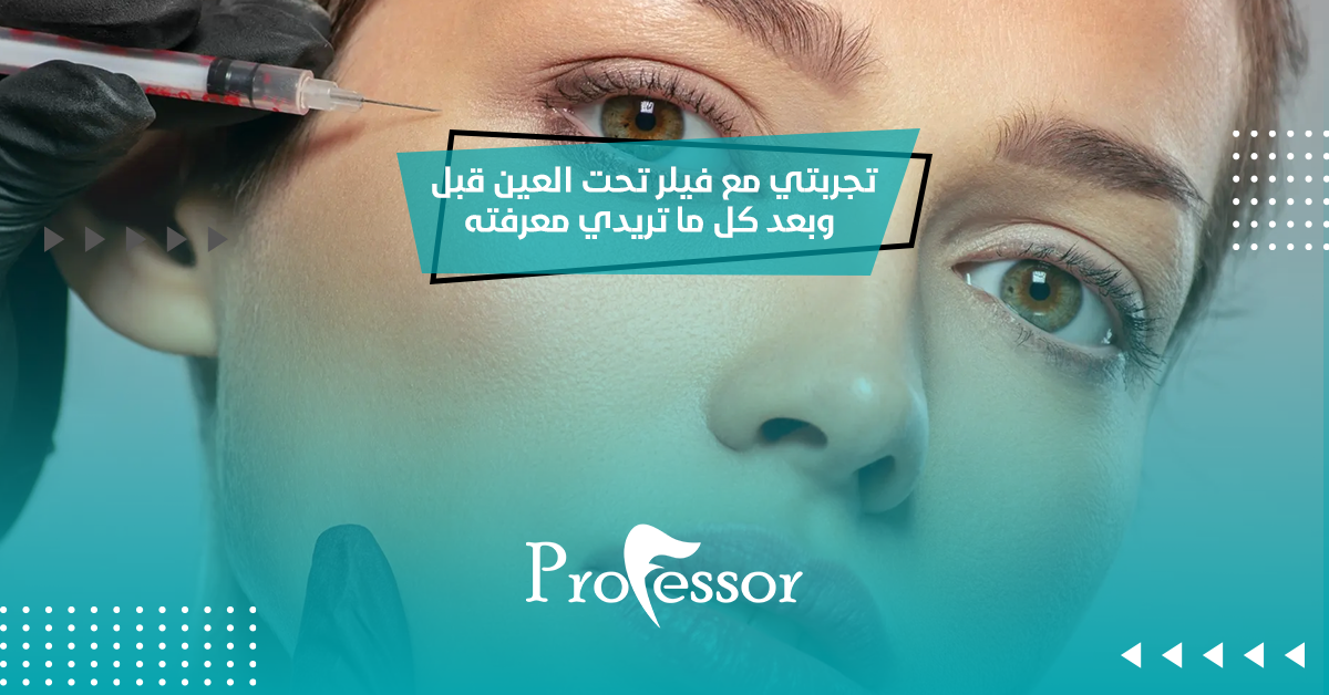 تجربتي مع فيلر تحت العين قبل وبعد كل ما تريدي معرفته