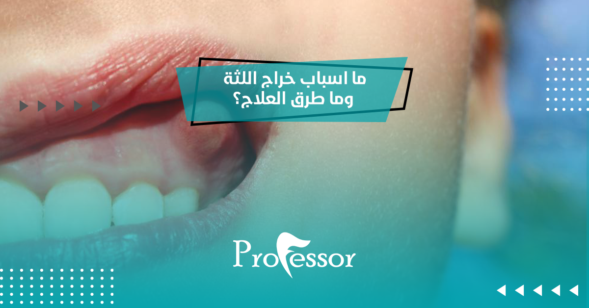 ما اسباب خراج اللثة وما طرق العلاج؟