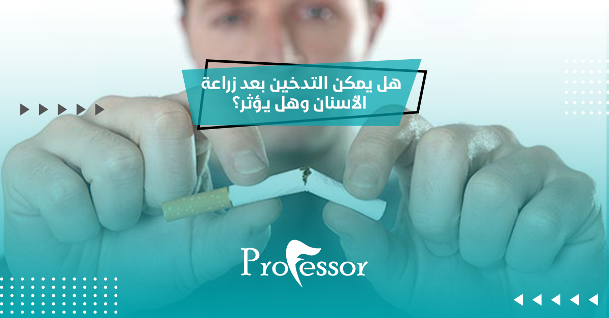 هل يمكن التدخين بعد زراعة الأسنان وهل يؤثر؟