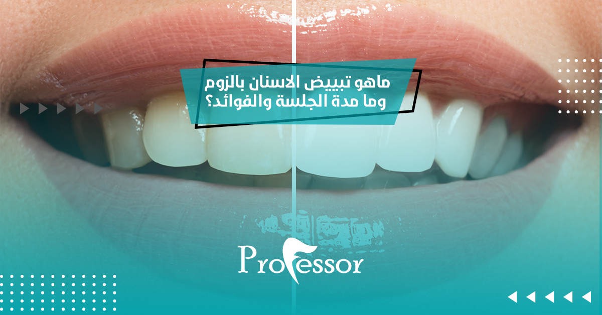 تبييض الاسنان بالزوم
