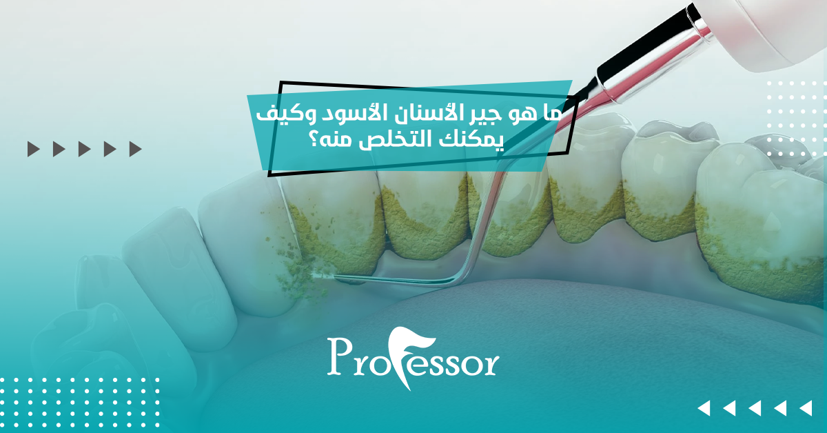 جير الأسنان الأسود