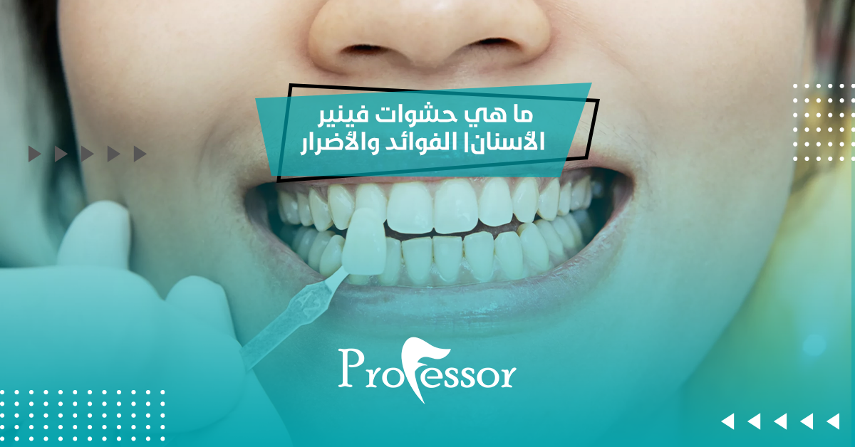 ما هي حشوات فينير الأسنان | الفوائد والأضرار