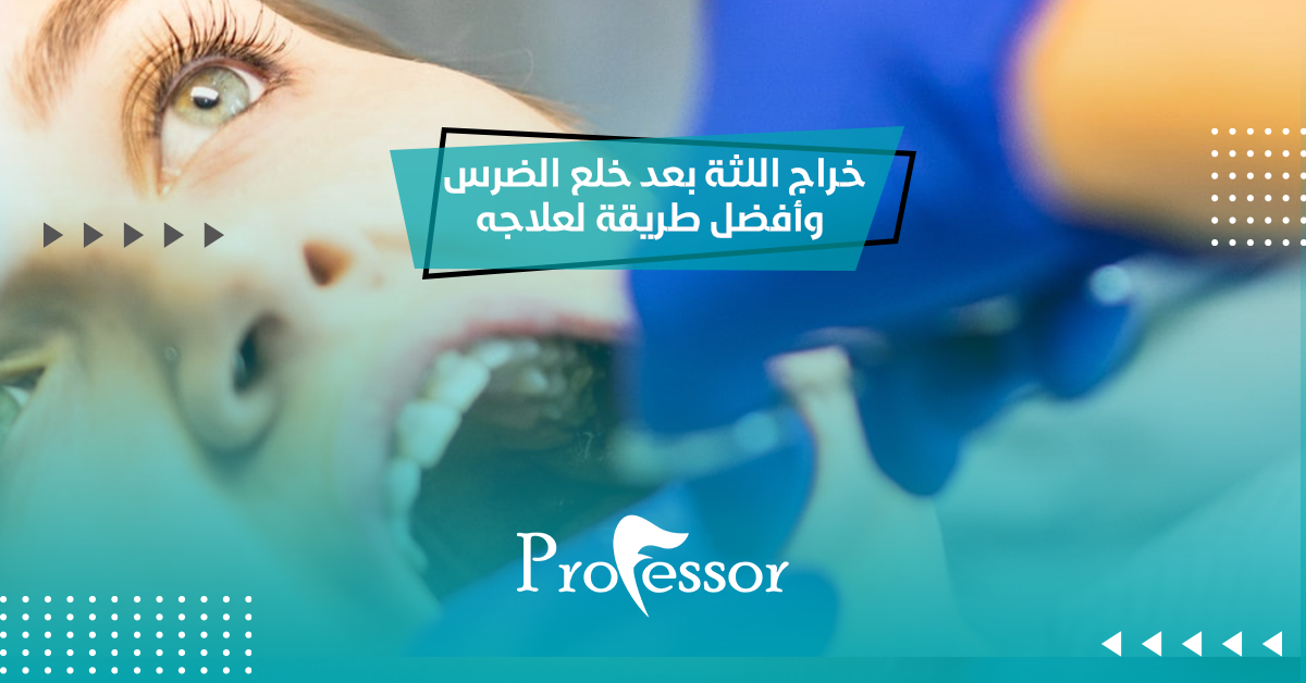 خراج اللثة بعد خلع الضرس وأفضل طريقة لعلاجه