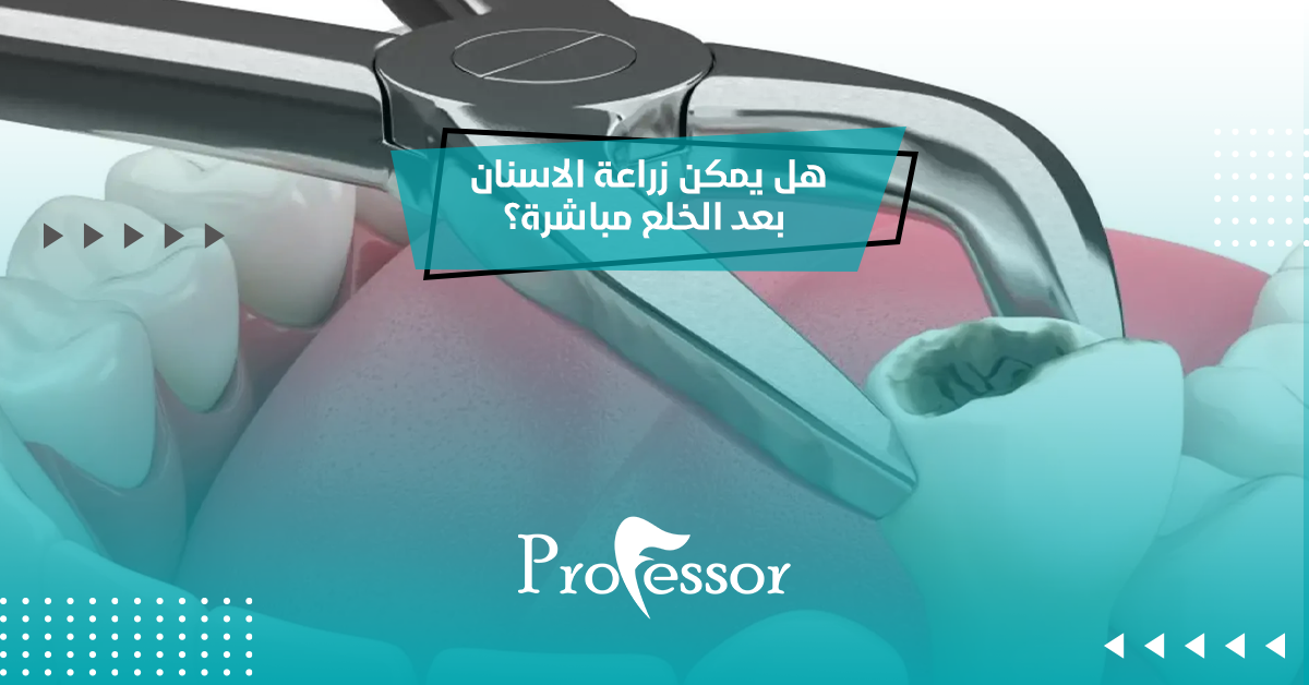 هل يمكن زراعة الاسنان بعد الخلع مباشرة؟
