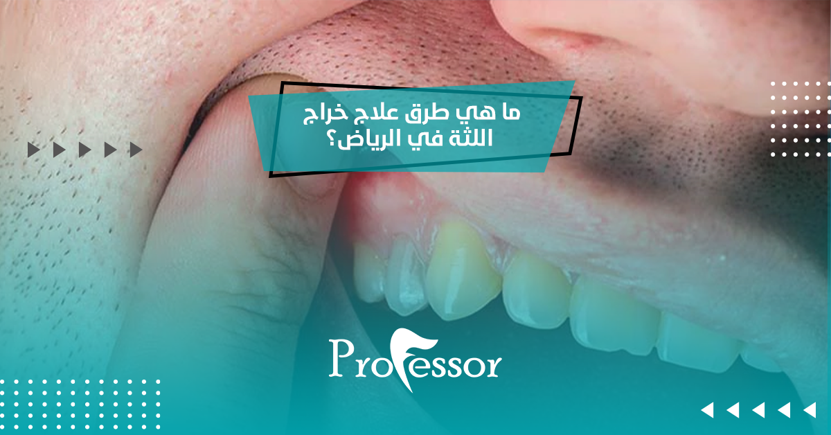ما هي طرق علاج خراج اللثة في الرياض؟