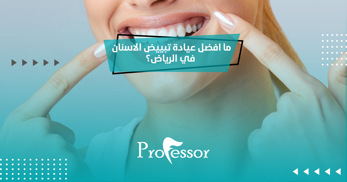 عيادة تبييض الاسنان