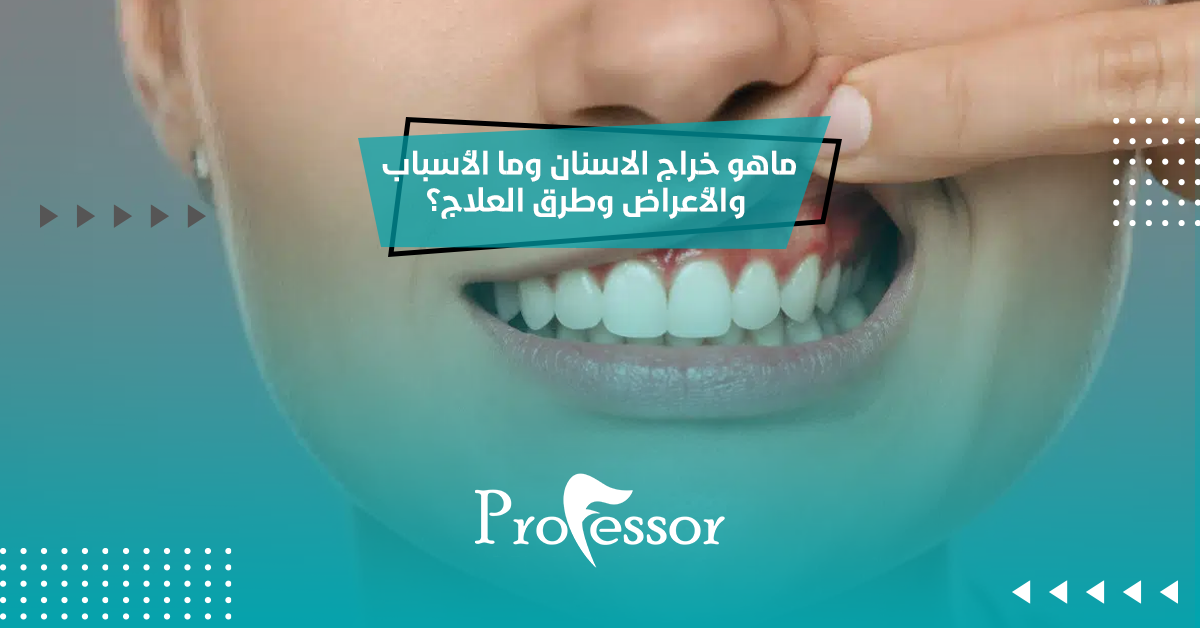 ماهو خراج الاسنان وما الأسباب والأعراض وطرق العلاج؟