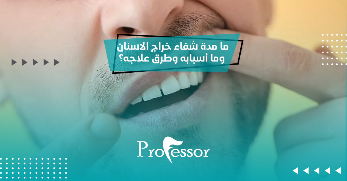 ما مدة شفاء خراج الاسنان وما أسبابه وطرق علاجه؟