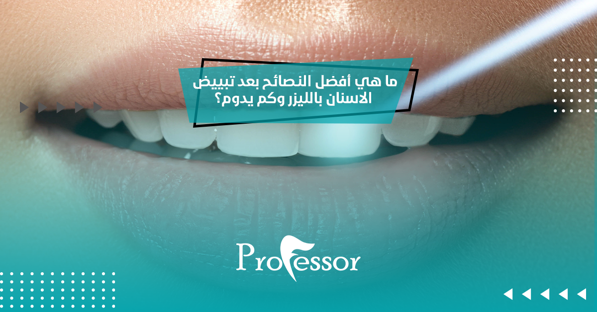 نصائح بعد تبييض الاسنان بالليزر