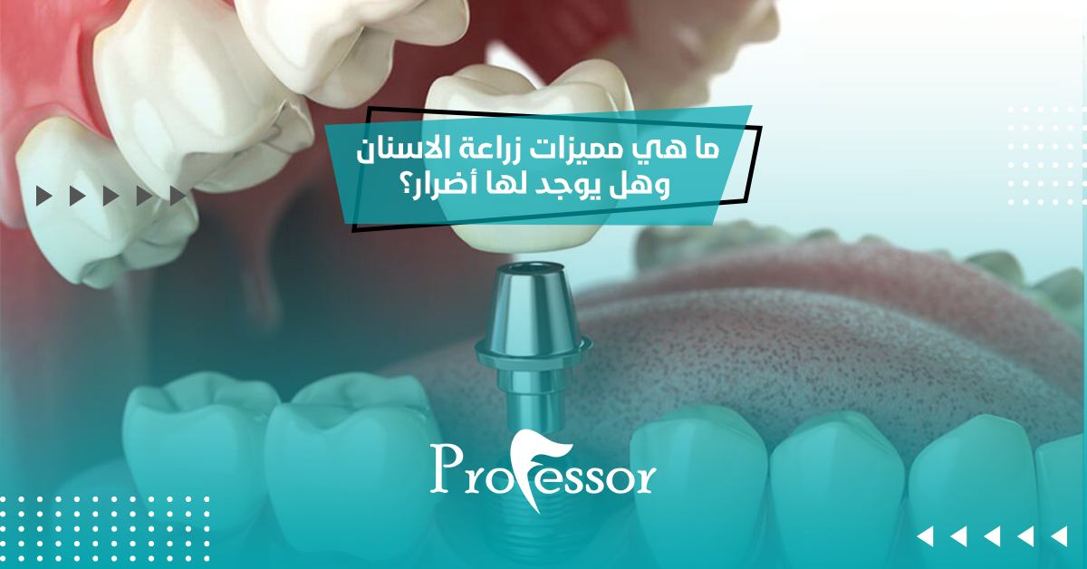 زراعة الاسنان