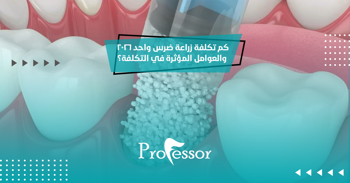 زراعة ضرس