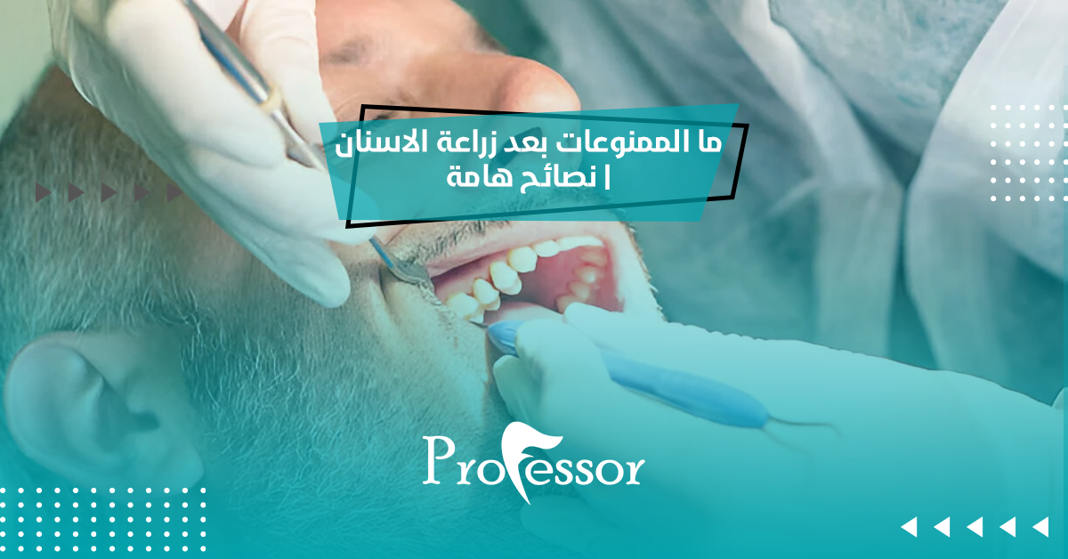 بعد زراعة الاسنان