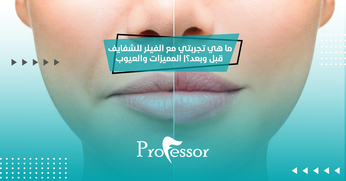 الفيلر للشفايف قبل وبعد