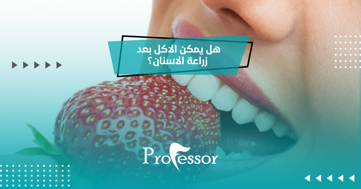 هل يمكن الاكل بعد زراعة الاسنان؟