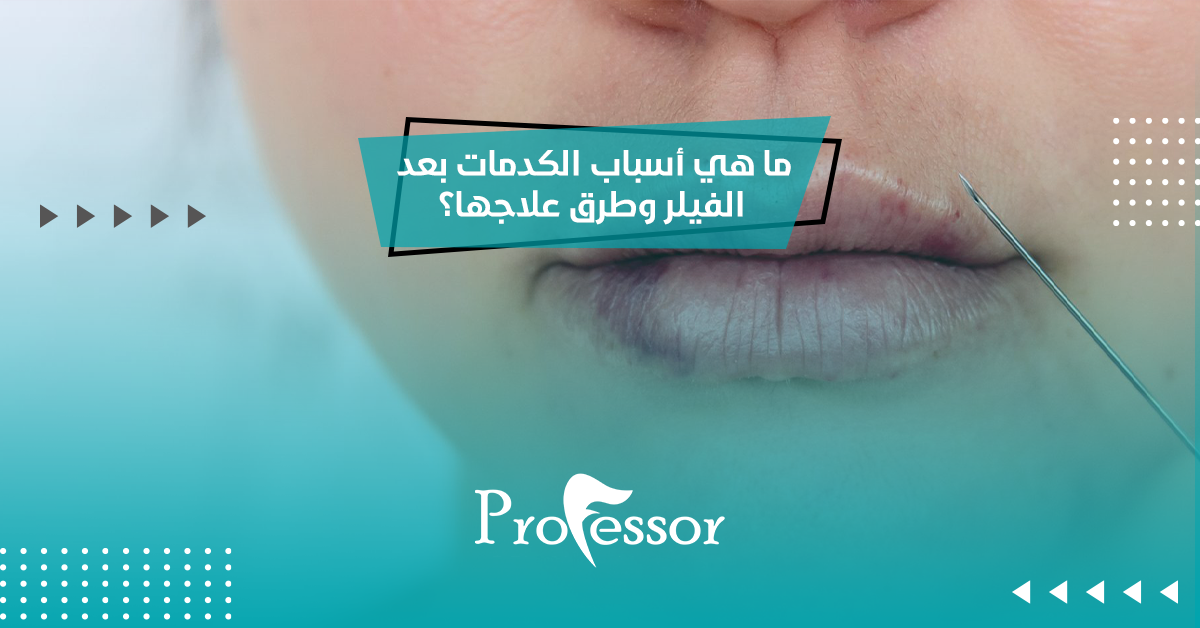 ما هي أسباب الكدمات بعد الفيلر وطرق علاجها؟