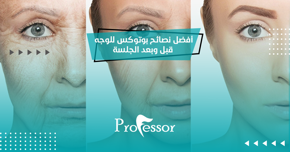 أفضل نصائح بوتوكس للوجه قبل وبعد الجلسة