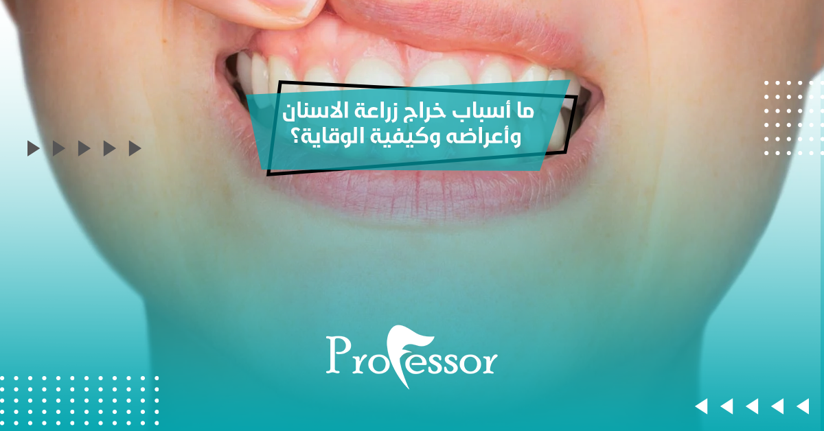 ما أسباب خراج زراعة الاسنان وأعراضه وكيفية الوقاية؟
