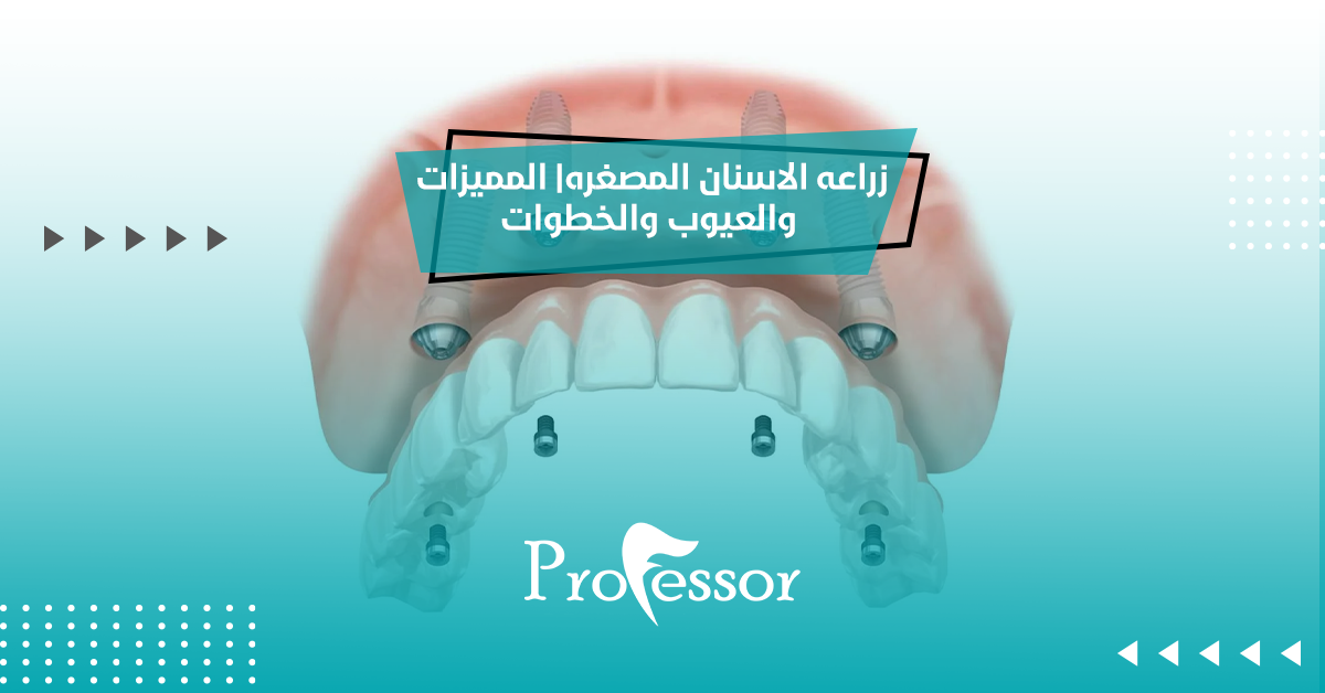 زراعه الاسنان المصغره