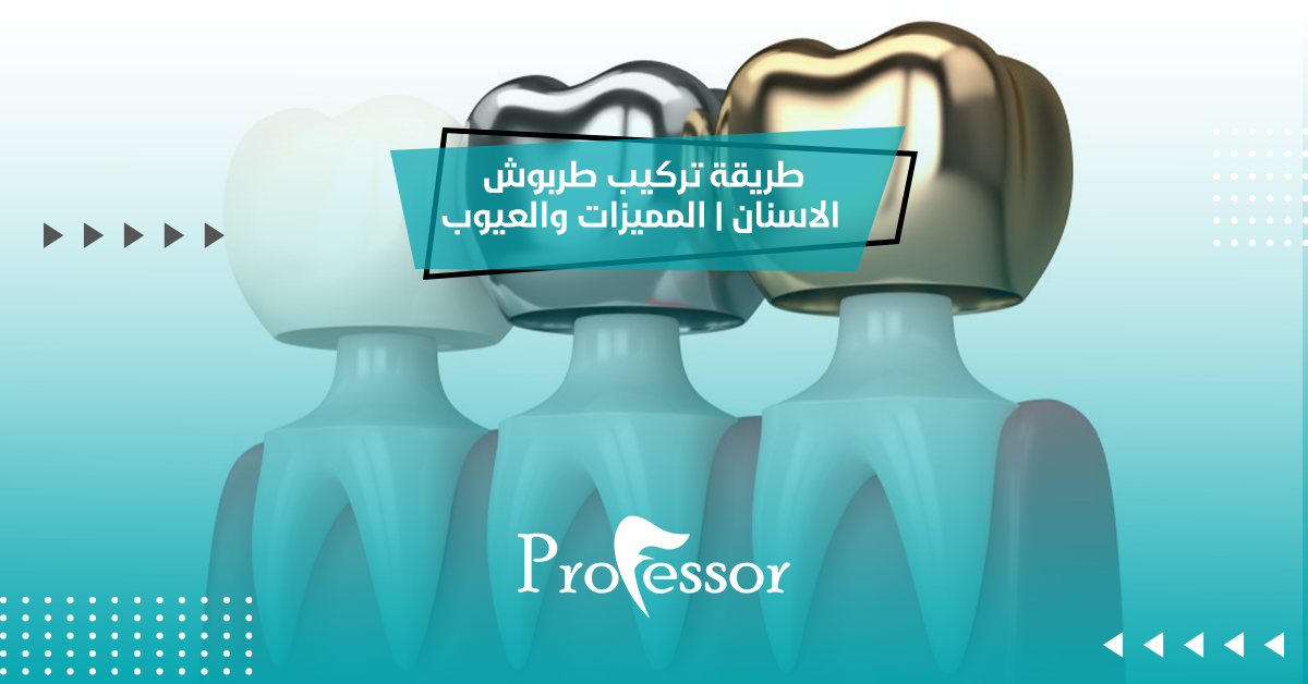 طربوش الاسنان