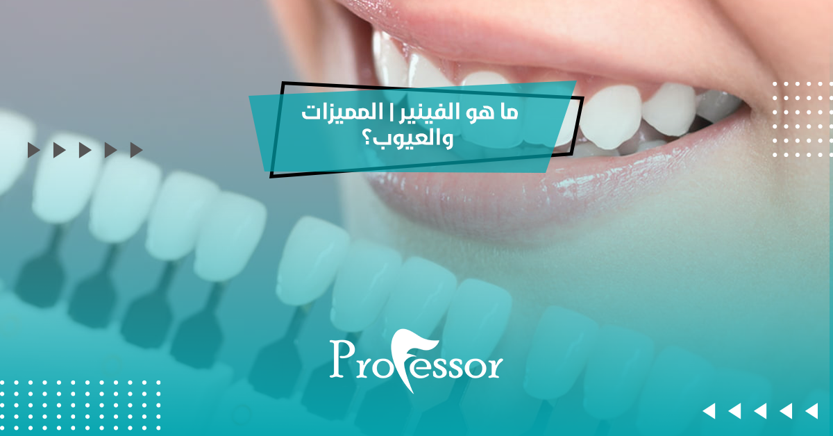 ما هو الفينير | المميزات والعيوب؟